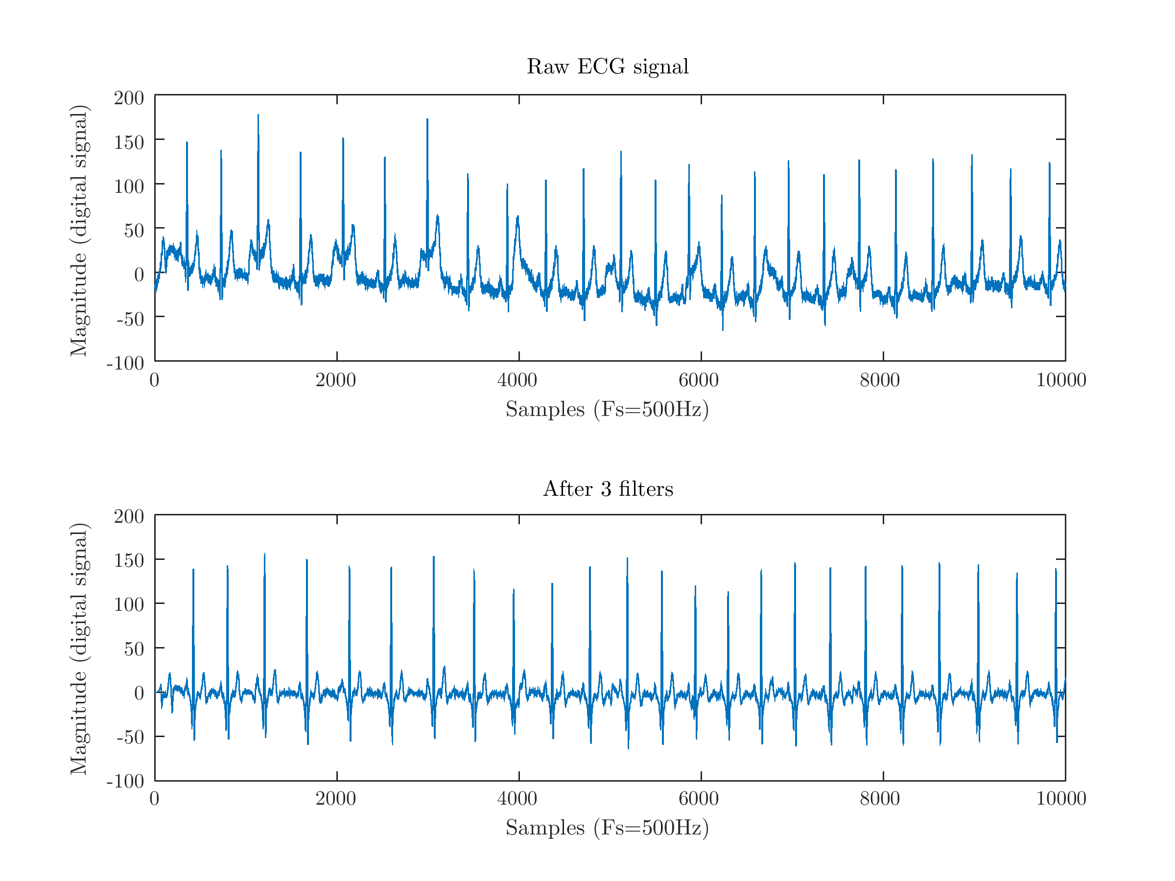 ECG raw and after 3 filters